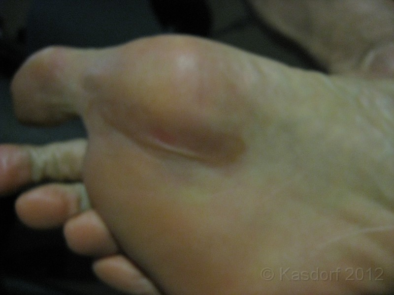 2012 Toronto WM 158.jpg - My excuse: Shoes got wet walking to the start line. The water caused blisters inside of three miles. I stopped and retied shoes tighter to prevent slipping around, but it continued to get worse throughout the rece.